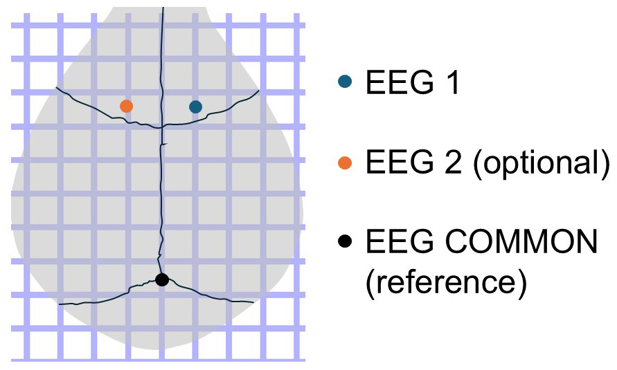 Needle Implant Configuration 4